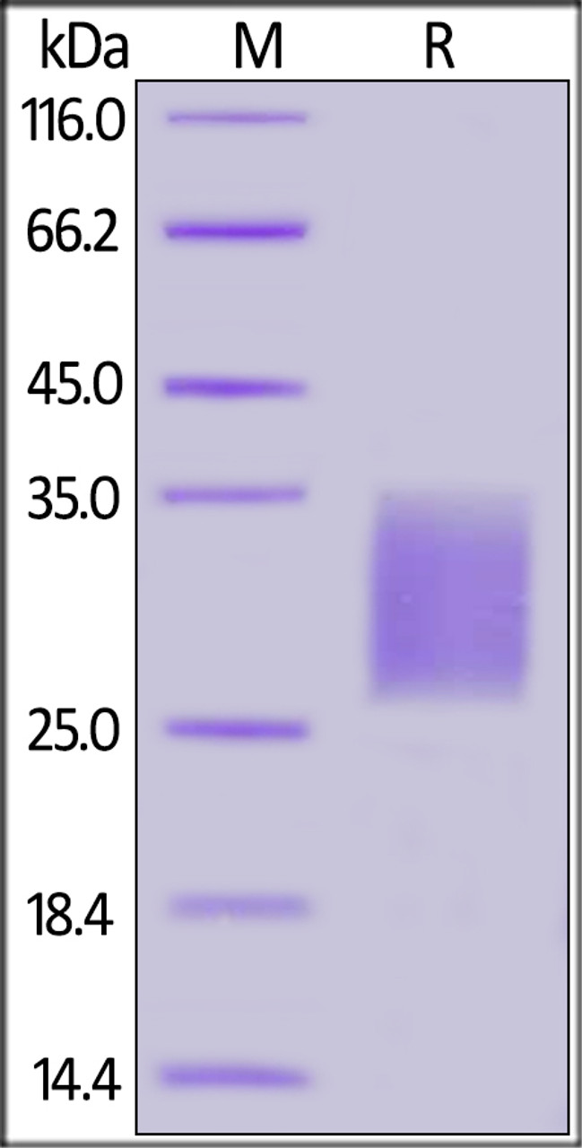 Human CD7, His Tag on SDS-PAGE under reducing (R) condition. The gel was stained overnight with Coomassie Blue. The purity of the protein is greater than 90%.
