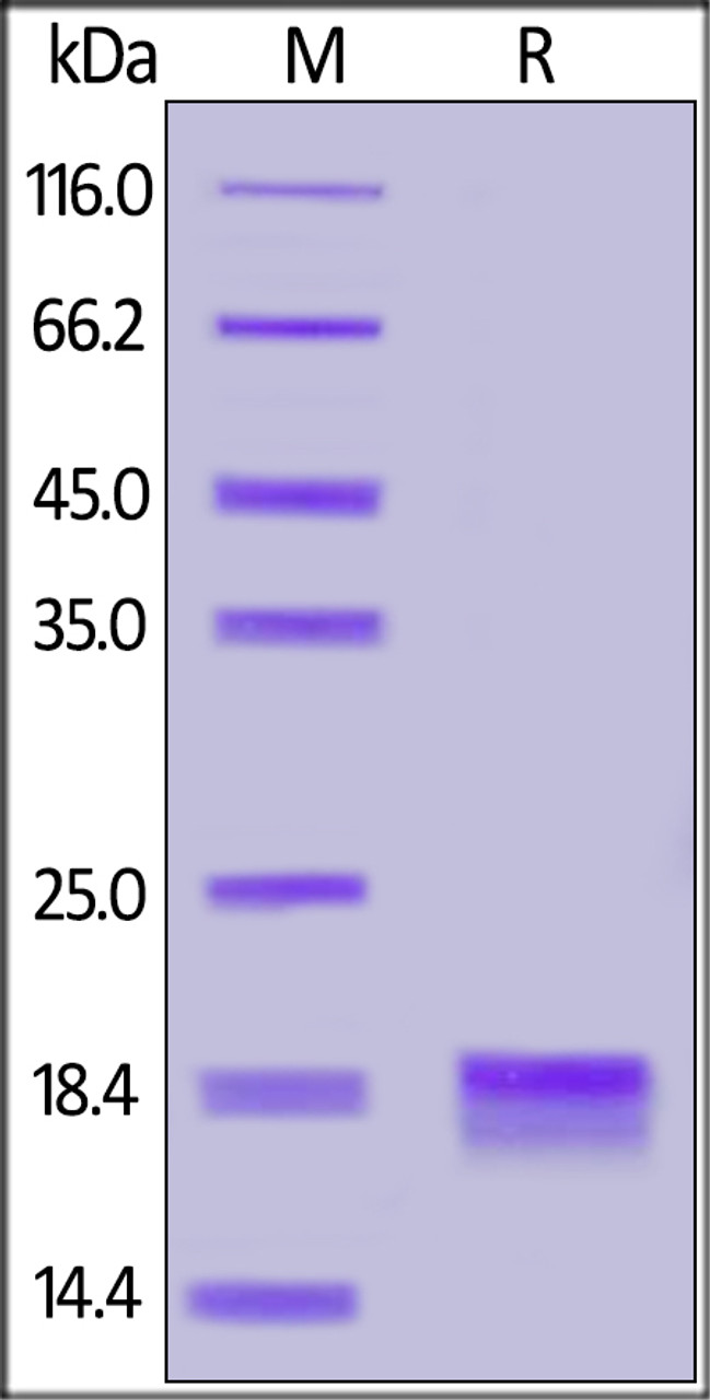 Human IL-2, His Tag on SDS-PAGE under reducing (R) condition. The gel was stained overnight with Coomassie Blue. The purity of the protein is greater than 90%.