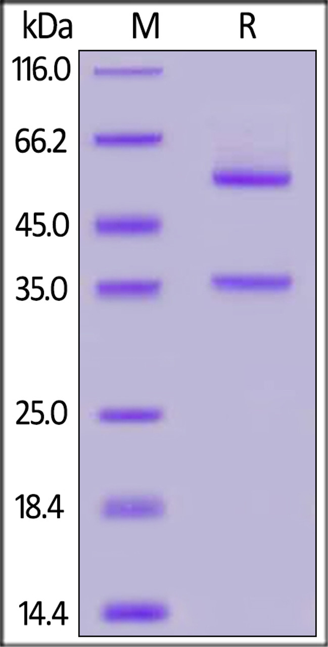 Human Glypican 2, Fc Tag on SDS-PAGE under reducing (R) condition. The gel was stained overnight with Coomassie Blue. The purity of the protein is greater than 95%.