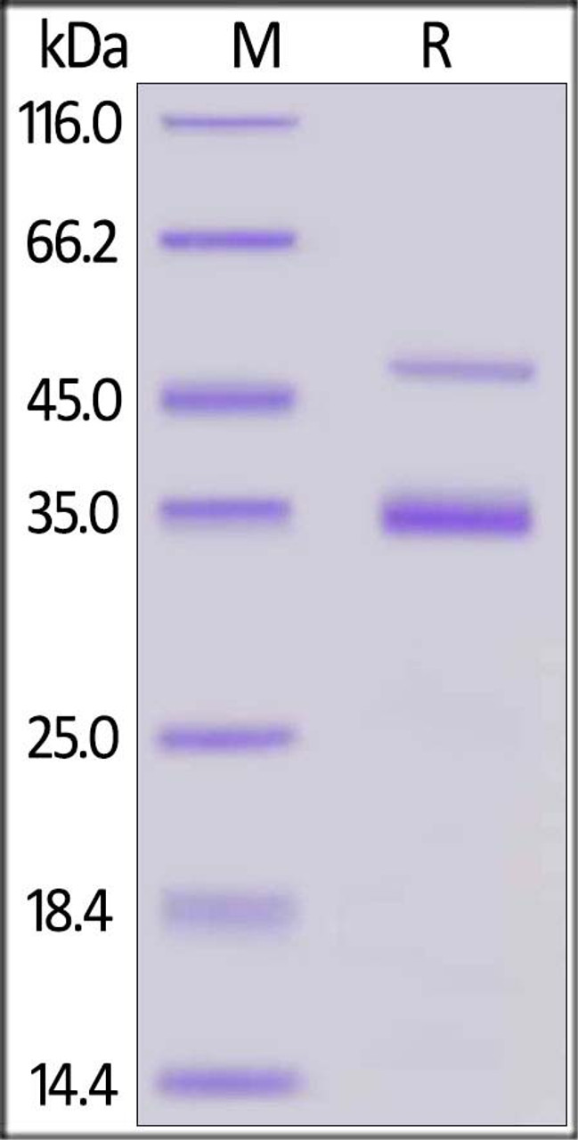 Human Coagulation factor XI, His Tag on SDS-PAGE under reducing (R) condition. The gel was stained overnight with Coomassie Blue. The purity of the protein is greater than 90%.