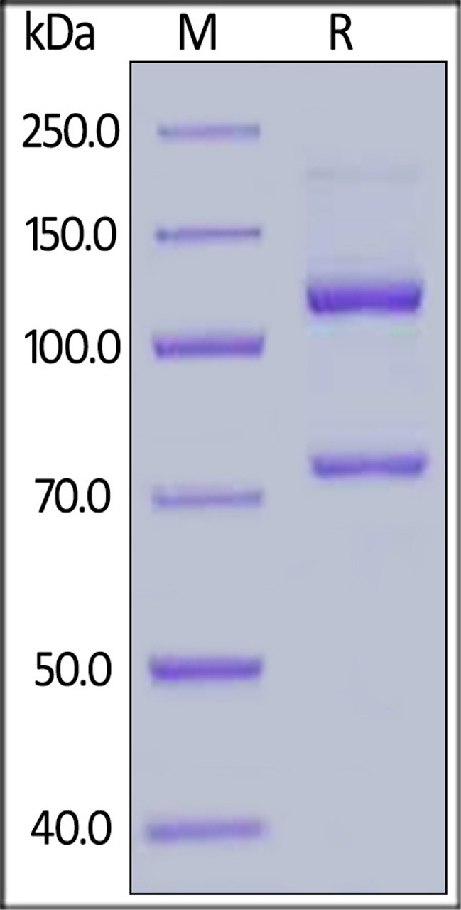 Human Complement C5 (w917s) , His Tag on SDS-PAGE under reducing (R) condition. The gel was stained overnight with Coomassie Blue. The purity of the protein is greater than 95%.