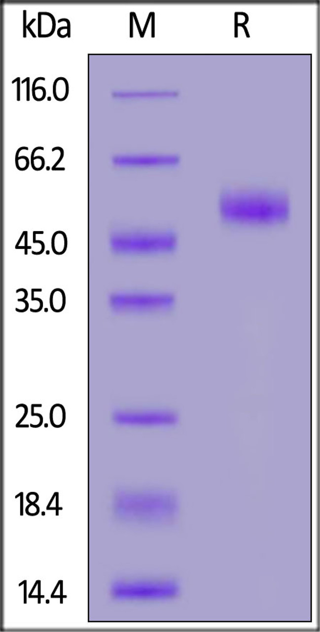 Human MIS RII, Fc Tag on SDS-PAGE under reducing (R) condition. The gel was stained overnight with Coomassie Blue. The purity of the protein is greater than 95%.