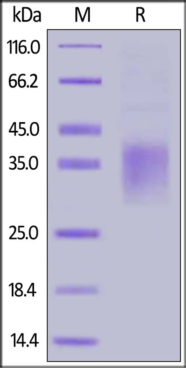 Human NKG2A, His Tag on SDS-PAGE under reducing (R) condition. The gel was stained overnight with Coomassie Blue. The purity of the protein is greater than 90%.