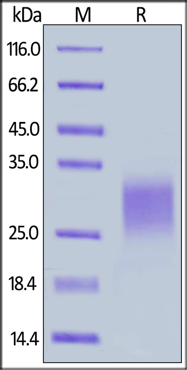 Canine TIGIT, His Tag on SDS-PAGE under reducing (R) condition. The gel was stained overnight with Coomassie Blue. The purity of the protein is greater than 90%.