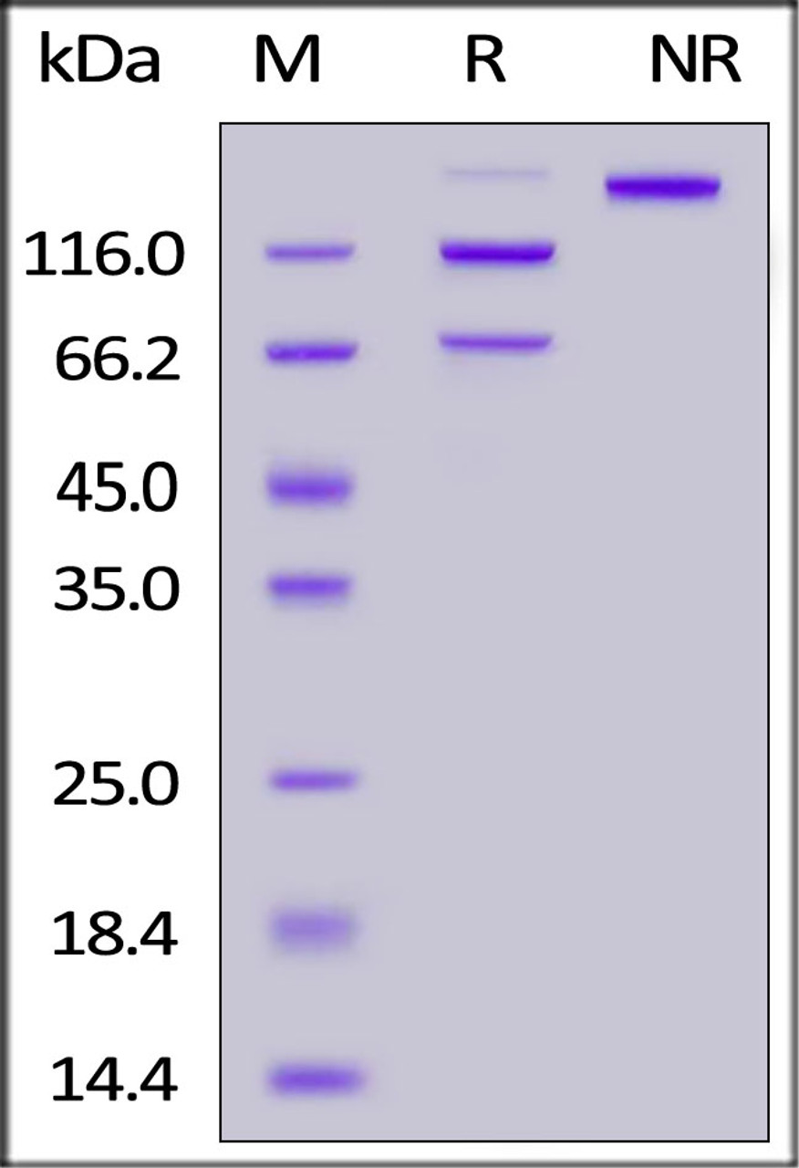 Human Complement C5 (R885H) , His Tag on SDS-PAGE under reducing (R) and non-reducing (NR) conditions. The gel was stained overnight with Coomassie Blue. The purity of the protein is greater than 90%.