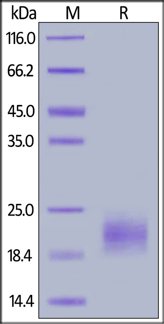 Human IL-5, His Tag on SDS-PAGE under reducing (R) condition. The gel was stained overnight with Coomassie Blue. The purity of the protein is greater than 90%.