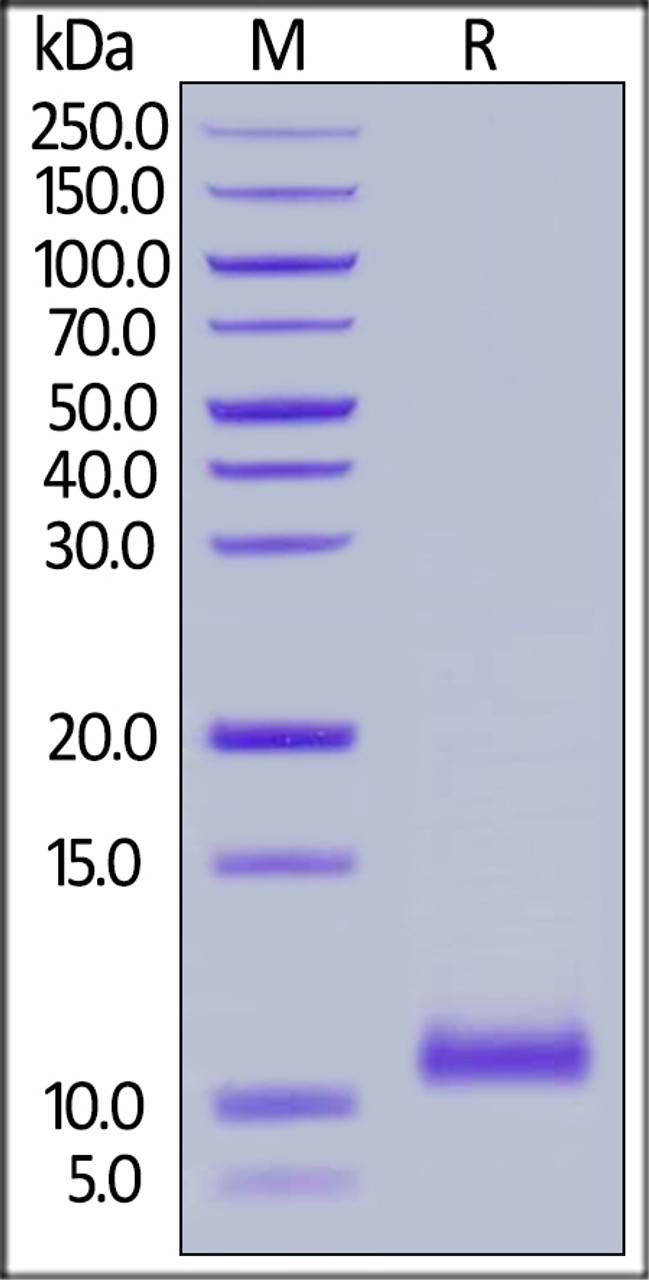 Cynomolgus C5a, Tag Free on SDS-PAGE under reducing (R) condition. The gel was stained overnight with Coomassie Blue. The purity of the protein is greater than 95%.