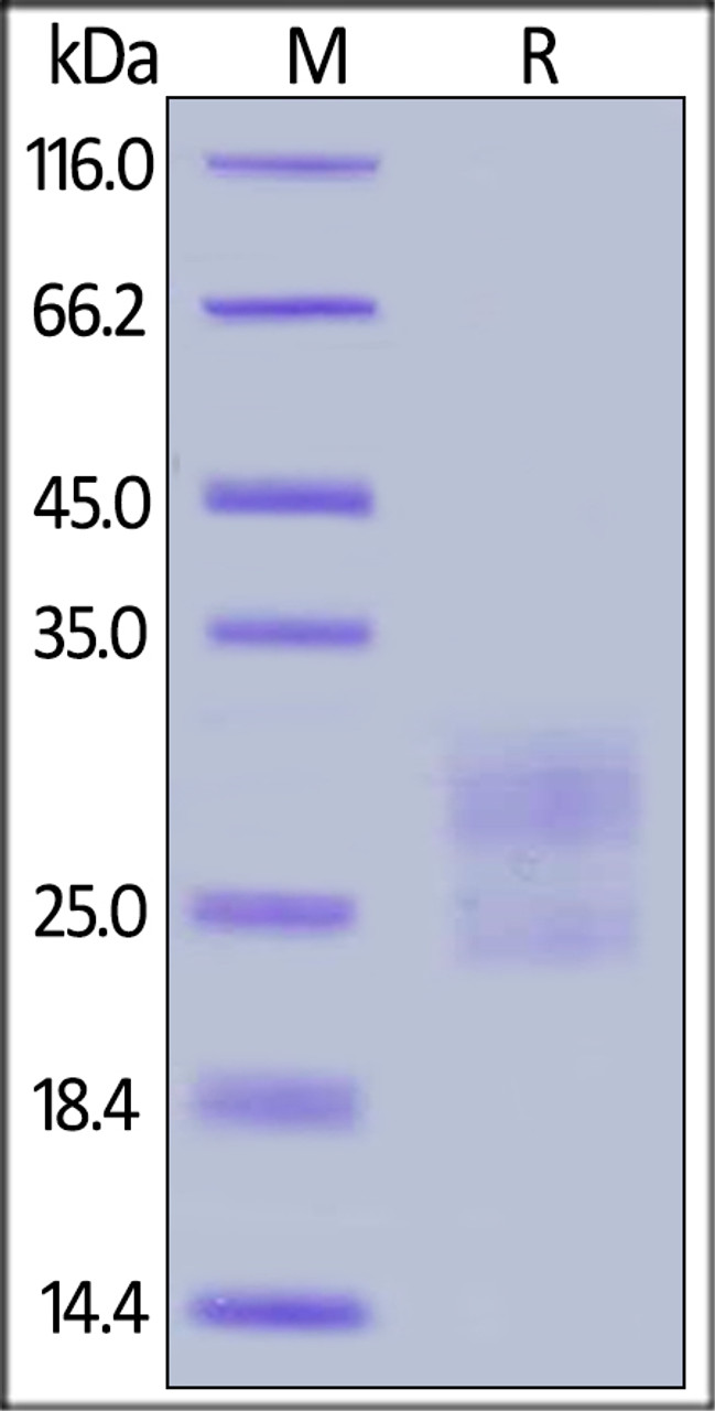 Mouse ICOS (C137S, C138S) , His Tag on SDS-PAGE under reducing (R) condition. The gel was stained overnight with Coomassie Blue. The purity of the protein is greater than 90%.