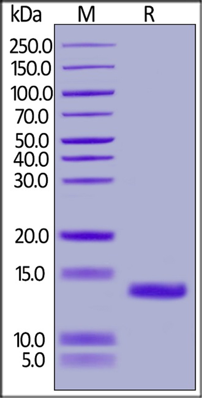 Mouse C5a, His Tag on SDS-PAGE under reducing (R) condition. The gel was stained overnight with Coomassie Blue. The purity of the protein is greater than 95%.