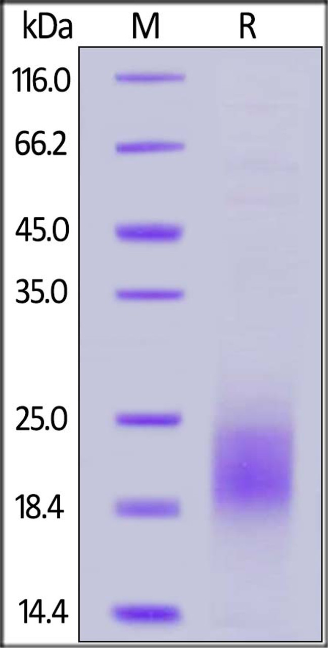 Human PSCA, His Tag on SDS-PAGE under reducing (R) condition. The gel was stained overnight with Coomassie Blue. The purity of the protein is greater than 90%.