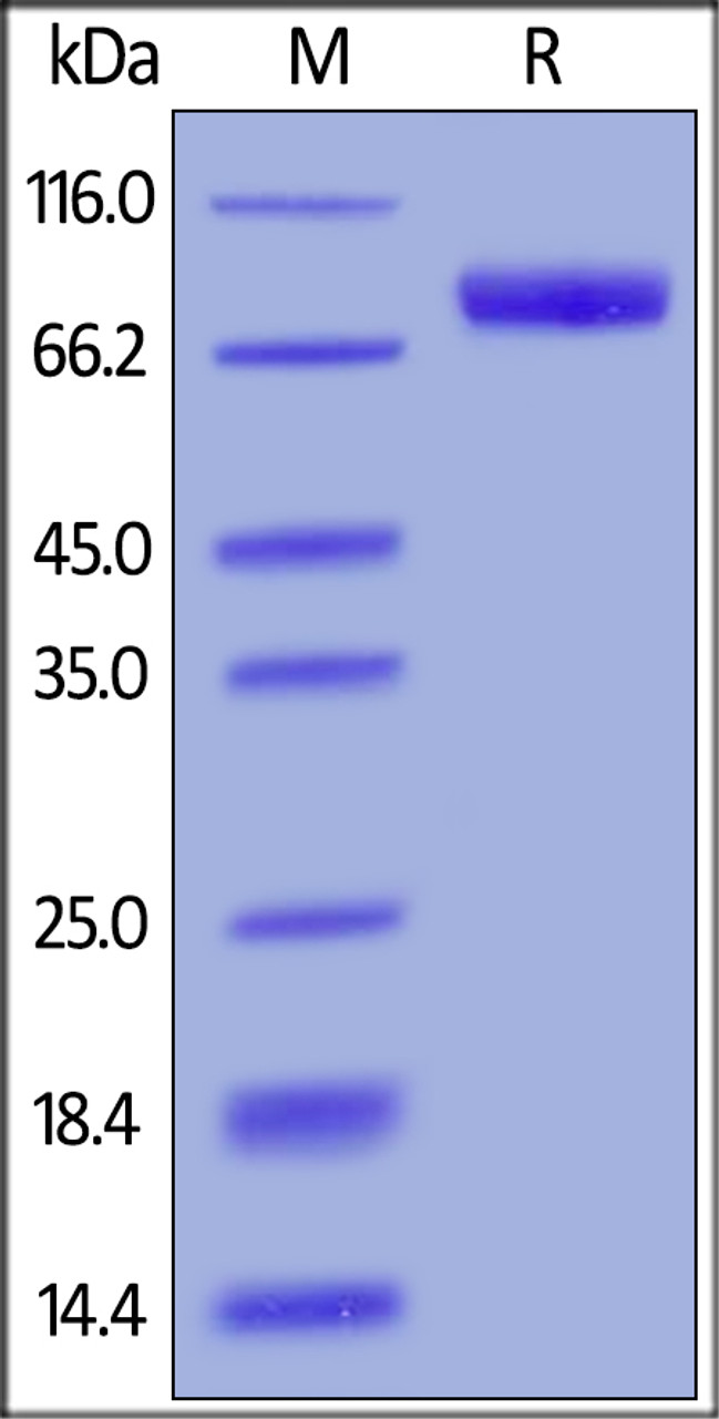 Human IL-6 R alpha, Fc Tag on SDS-PAGE under reducing (R) condition. The gel was stained overnight with Coomassie Blue. The purity of the protein is greater than 95%.