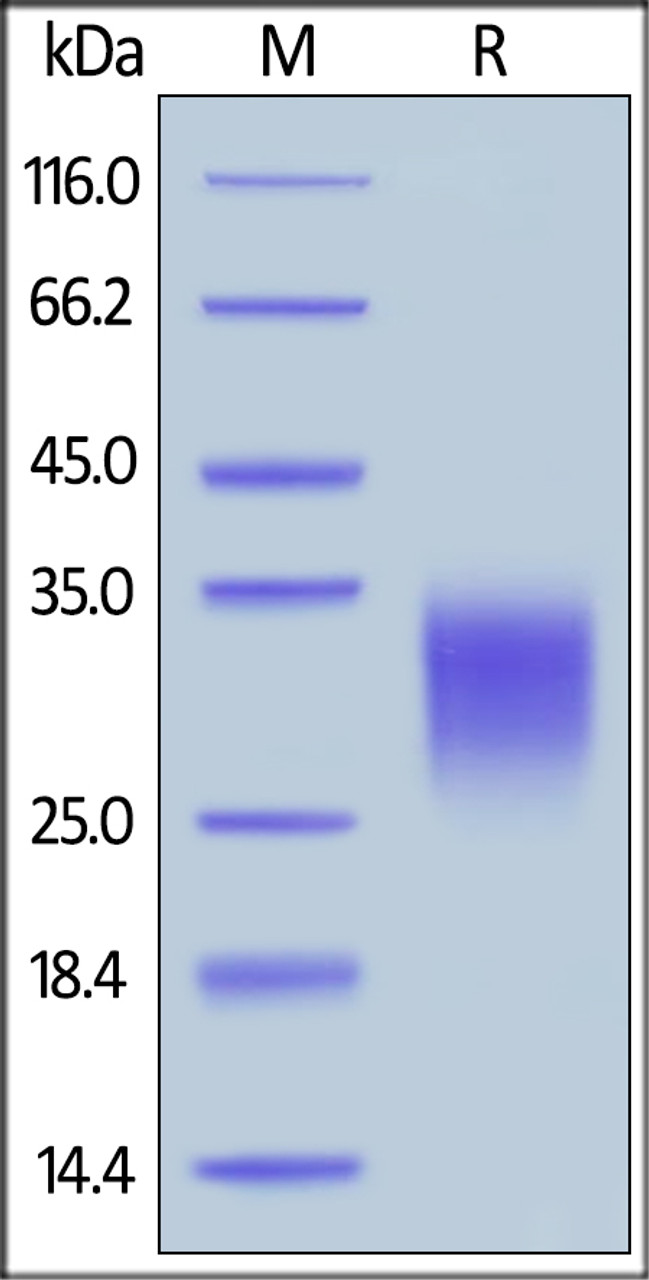 Human IL-22, His Tag on SDS-PAGE under reducing (R) condition. The gel was stained overnight with Coomassie Blue. The purity of the protein is greater than 90%.