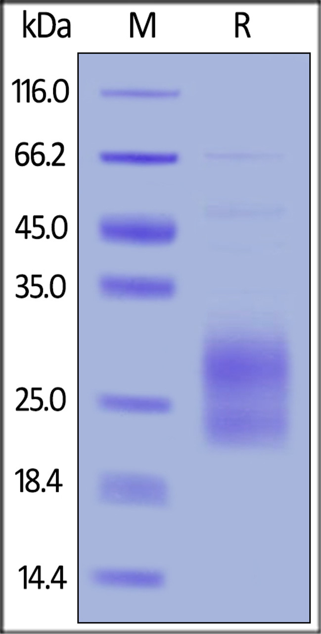 Human ICOS (C136S, C137S) , His Tag on SDS-PAGE under reducing (R) condition. The gel was stained overnight with Coomassie Blue. The purity of the protein is greater than 85%.