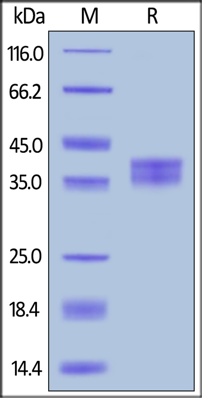 Llama IgG2b Fc, Tag Free on SDS-PAGE under reducing (R) condition. The gel was stained overnight with Coomassie Blue. The purity of the protein is greater than 90%.