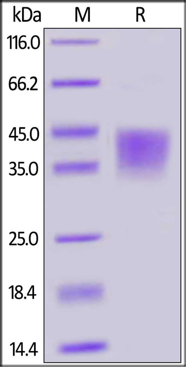 Human / Cynomolgus / Rhesus macaque CD28, His Tag on SDS-PAGE under reducing (R) condition. The gel was stained overnight with Coomassie Blue. The purity of the protein is greater than 90%.