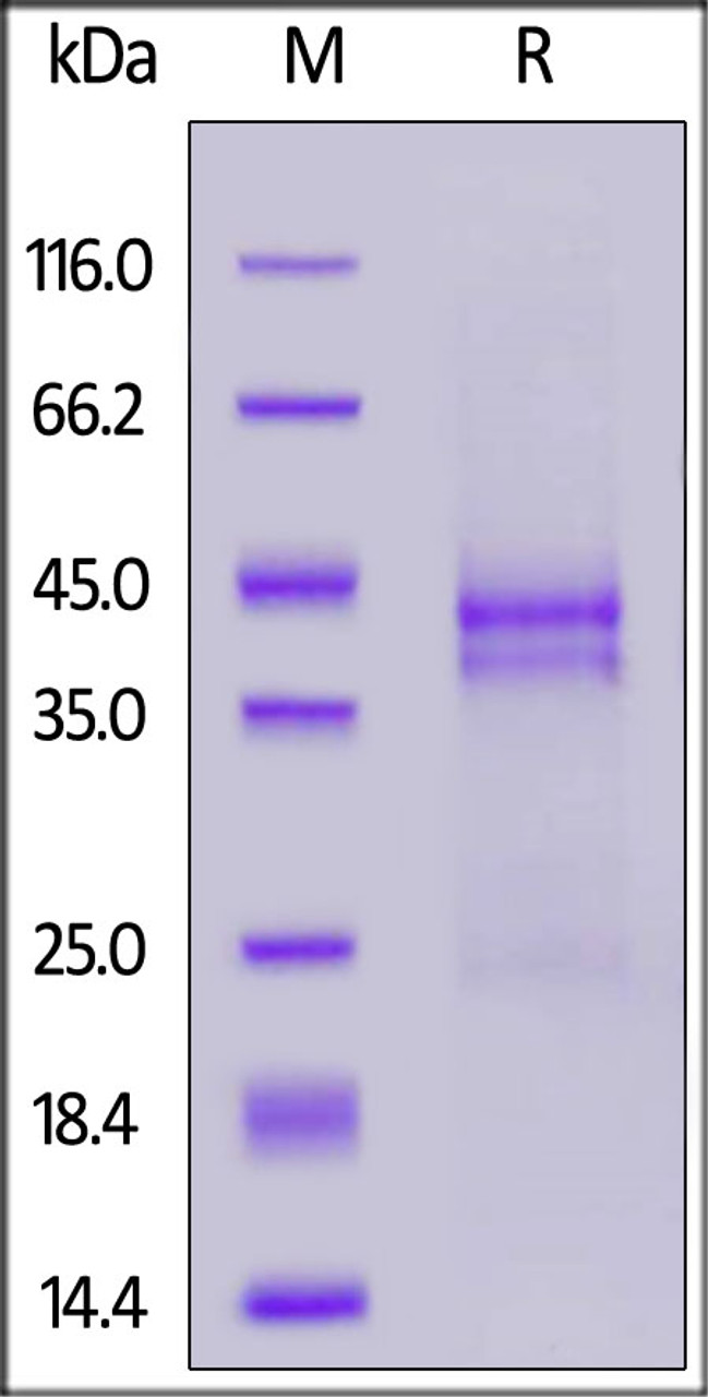 Human CTGF, His Tag on SDS-PAGE under reducing (R) condition. The gel was stained overnight with Coomassie Blue. The purity of the protein is greater than 90%.