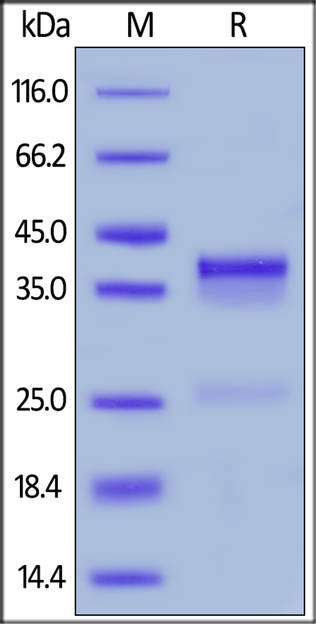 Mouse CTGF, His Tag on SDS-PAGE under reducing (R) condition. The gel was stained overnight with Coomassie Blue. The purity of the protein is greater than 90%.
