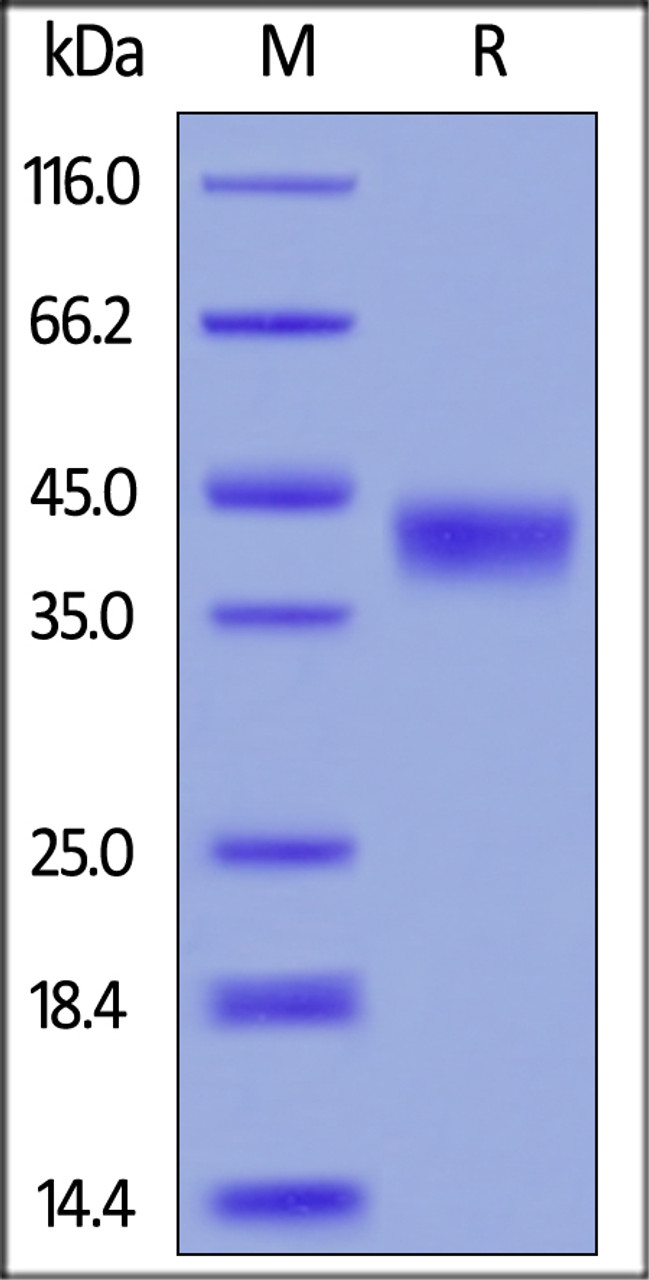 Mouse CD38, His Tag on SDS-PAGE under reducing (R) condition. The gel was stained overnight with Coomassie Blue. The purity of the protein is greater than 90%.