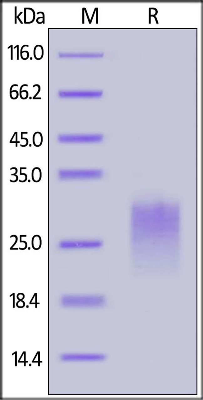 Human PVRIG, His Tag on SDS-PAGE under reducing (R) condition. The gel was stained overnight with Coomassie Blue. The purity of the protein is greater than 90%.