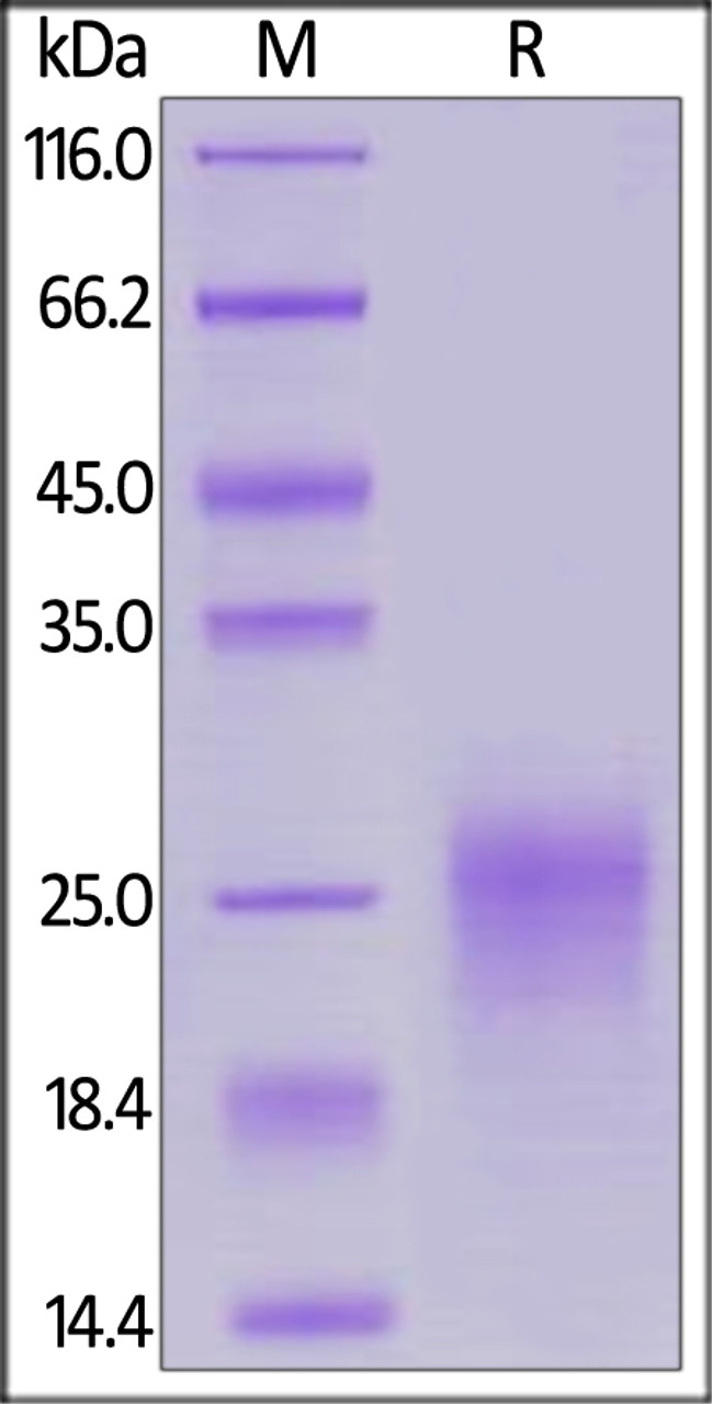 Human TSLP (R127A, R130A) , His Tag on SDS-PAGE under reducing (R) condition. The gel was stained overnight with Coomassie Blue. The purity of the protein is greater than 90%.