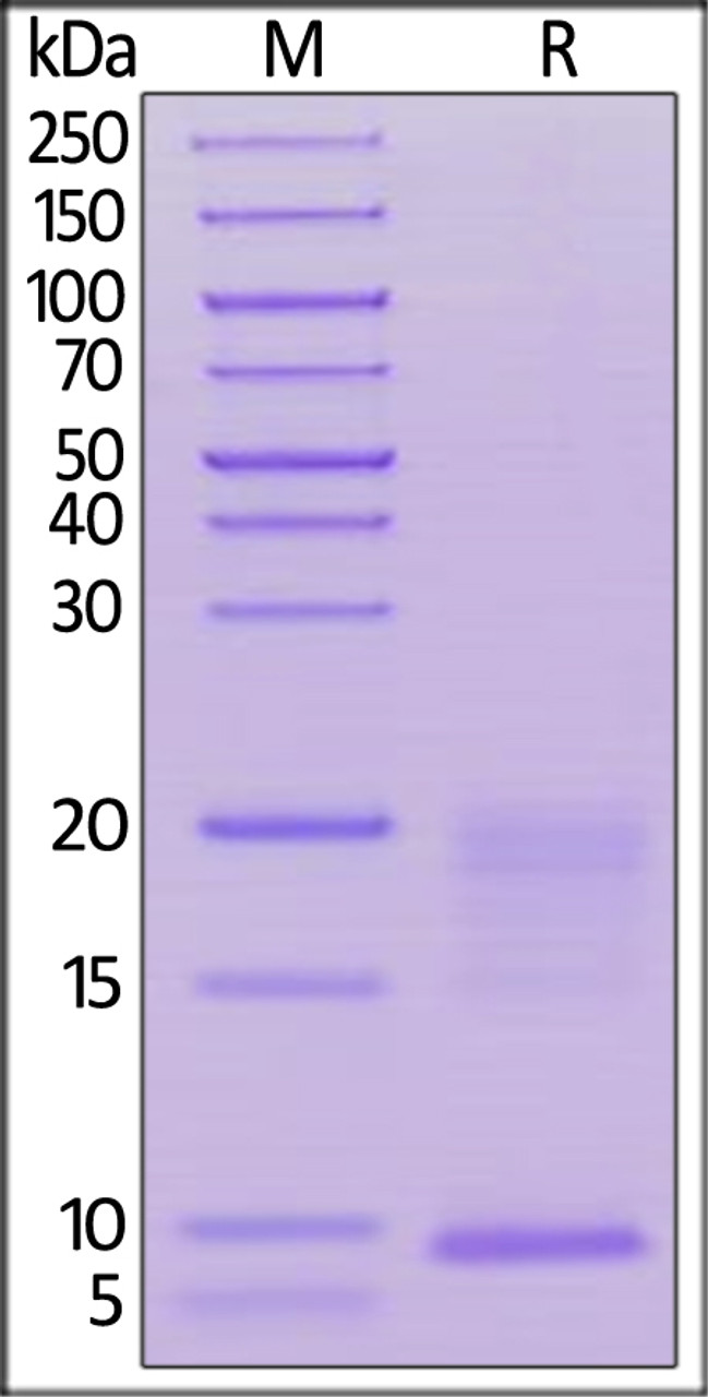 Human TSLP, His Tag on SDS-PAGE under reducing (R) condition. The gel was stained overnight with Coomassie Blue. The purity of the protein is greater than 90%.