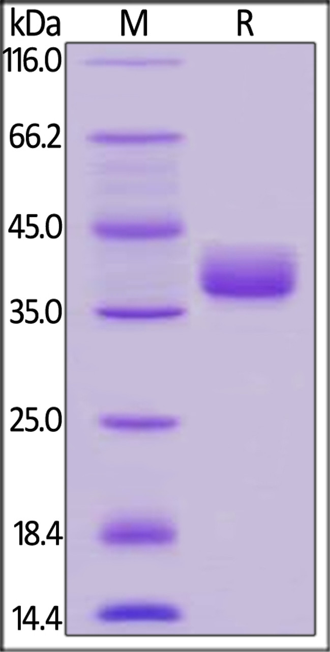 Human CD52, Fc Tag on SDS-PAGE under reducing (R) condition. The gel was stained overnight with Coomassie Blue. The purity of the protein is greater than 95%.