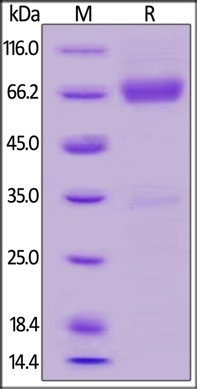 Human TSLP R, Fc Tag on SDS-PAGE under reducing (R) condition. The gel was stained overnight with Coomassie Blue. The purity of the protein is greater than 95%.