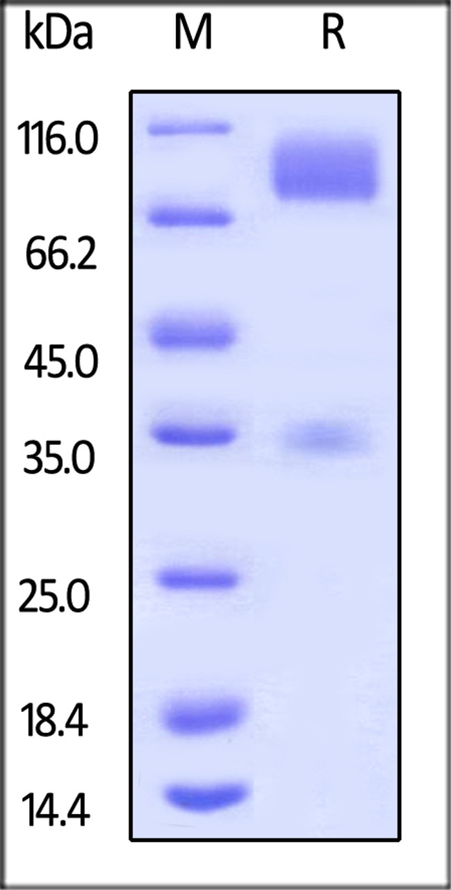 Mouse CD155, Mouse IgG2a Fc Tag on SDS-PAGE under reducing (R) condition. The gel was stained overnight with Coomassie Blue. The purity of the protein is greater than 95%.