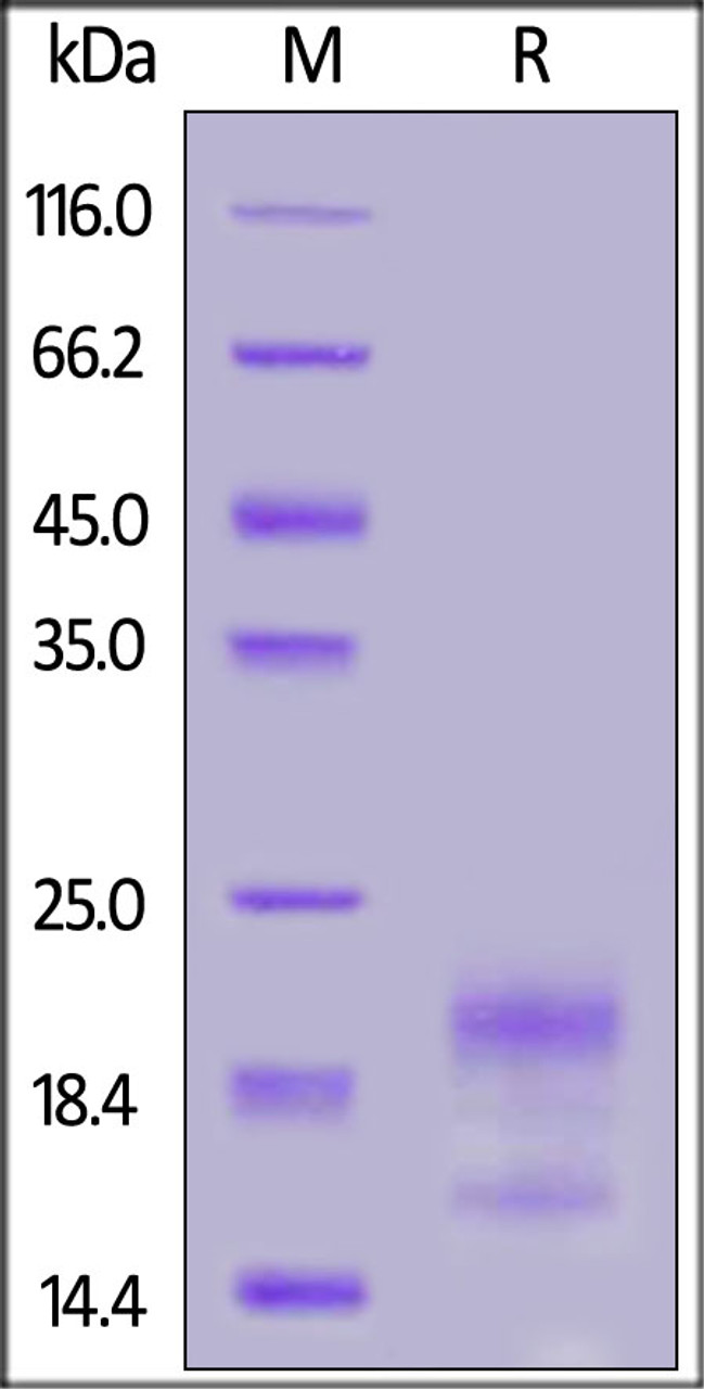 Human R-Spondin 3 (22-146) , His Tag on SDS-PAGE under reducing (R) condition. The gel was stained overnight with Coomassie Blue. The purity of the protein is greater than 90%.