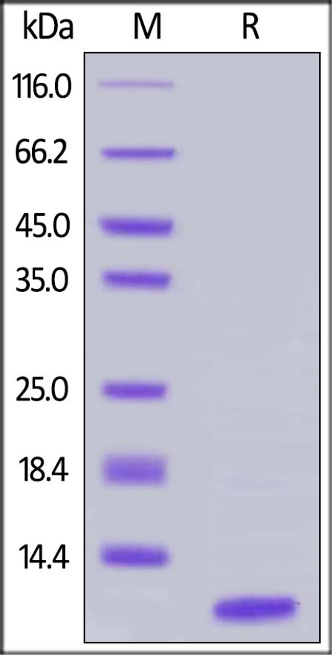 Human C5a, Tag Free on SDS-PAGE under reducing (R) condition. The gel was stained overnight with Coomassie Blue. The purity of the protein is greater than 95%.