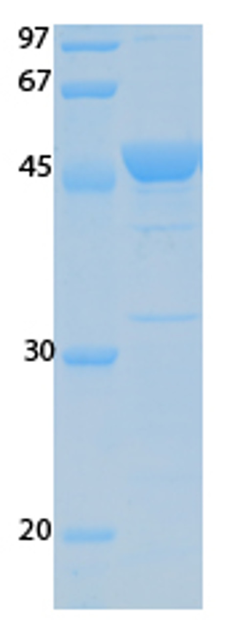 SARS-CoV-2 (COVID-19) ORF10 Recombinant Protein | 20-189