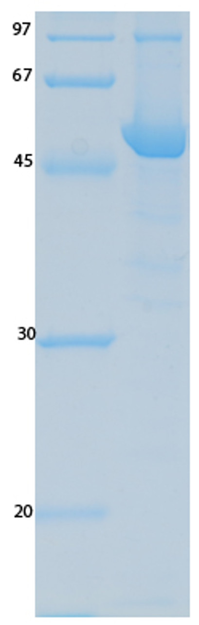 SARS-CoV-2 (COVID-19) ORF9B Recombinant Protein | 20-190