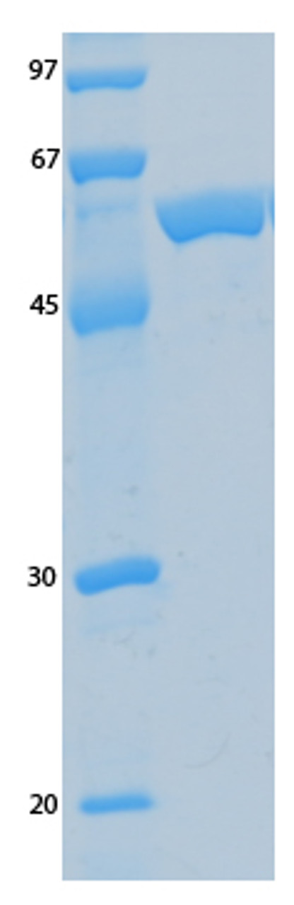 SARS-CoV-2 (COVID-19) ORF9A Recombinant Protein | 20-191