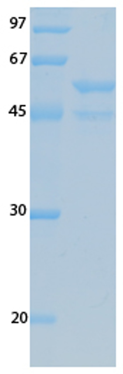 SARS-CoV-2 (COVID-19) ORF3B Recombinant Protein | 20-195