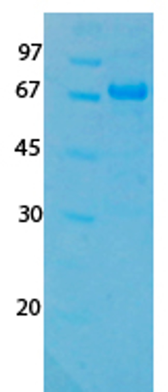 SARS-CoV-2 (COVID-19) ORF3A Recombinant Protein | 20-196