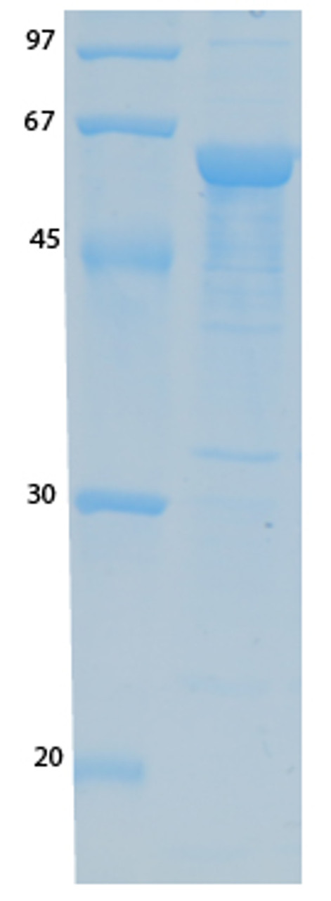 SARS Coronavirus Envelope (HSZ-Cc) Recombinant Protein | 20-197