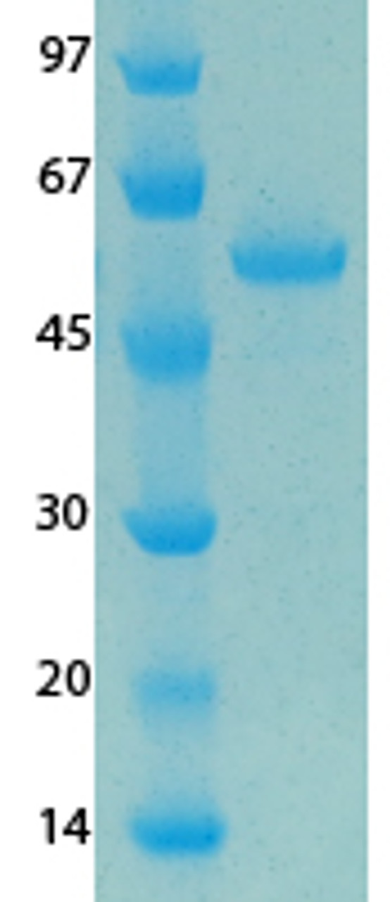 MERS Coronavirus Envelope (HSZ-Cc) Recombinant Protein | 20-198
