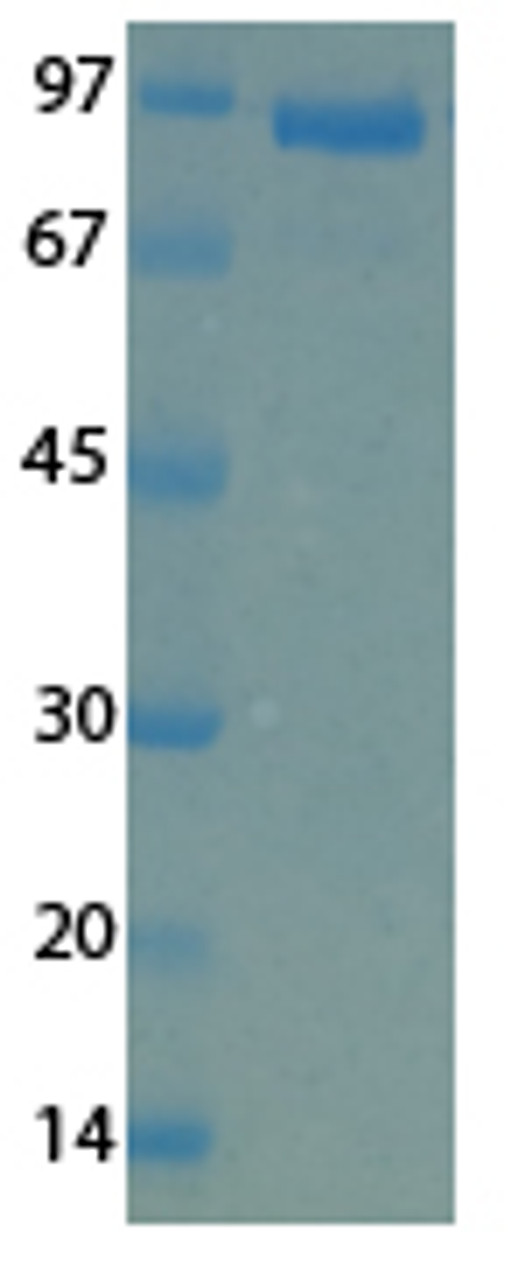 MERS Cornonavirus Envelope (HSZ-Cc) Recombinant Protein | 20-200