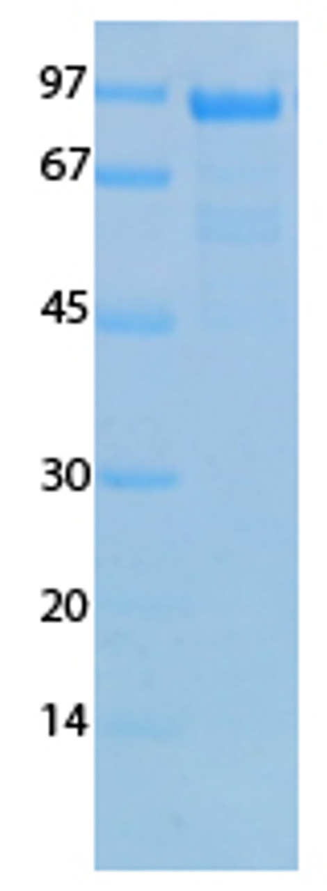 Human Coronavirus Nucleocapsid (229E) Recombinant Protein | 20-201