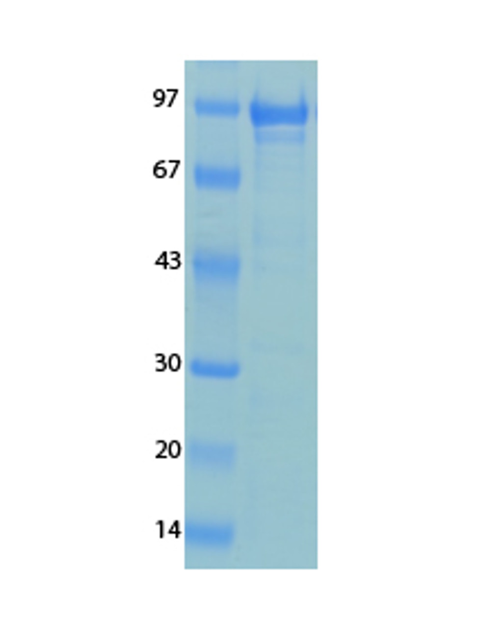 Human Coronavirus OC43 Recombinant Protein | 20-202