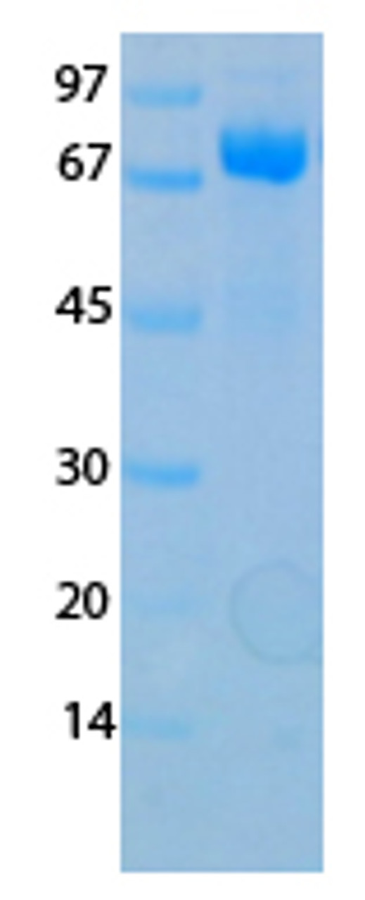 SARS-CoV-2 (COVID-19) NSP16 Recombinant Protein | 20-206