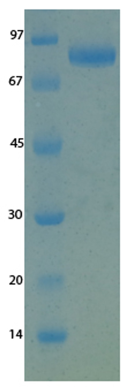 SARS-CoV-2 (COVID-19) NSP15 Recombinant Protein | 20-207