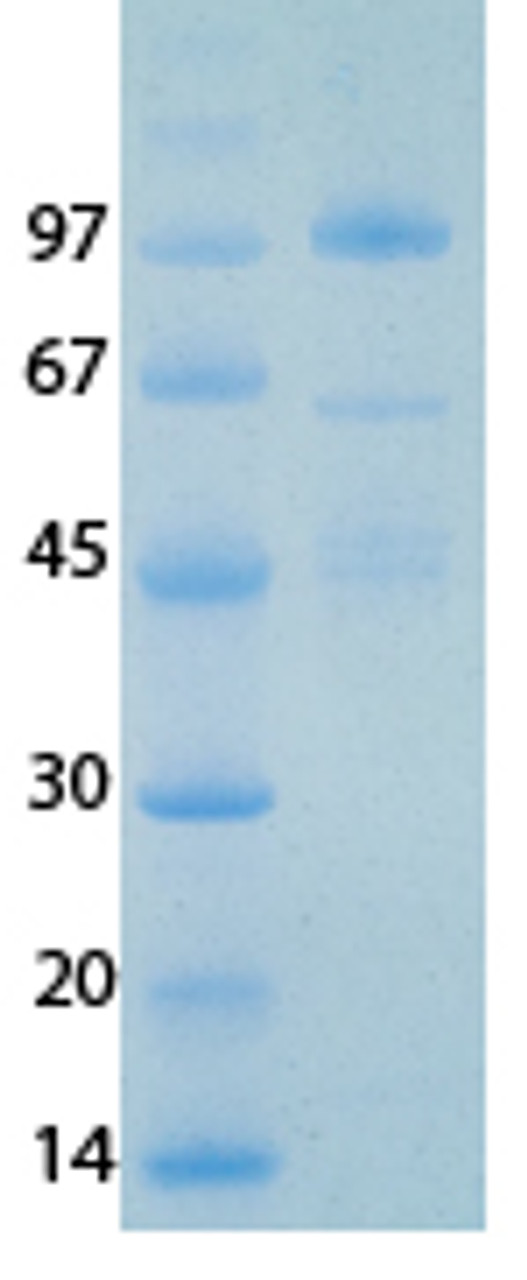 SARS-CoV-2 (COVID-19) NSP14 Recombinant Protein | 20-208