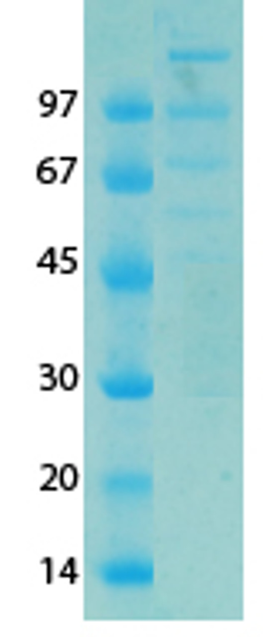 SARS-CoV-2 (COVID-19) NSP11 NSP12 Recombinant Protein | 20-210