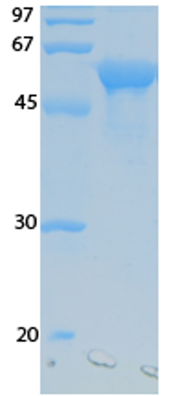 SARS-CoV-2 (COVID-19) NSP10 Recombinant Protein | 20-211