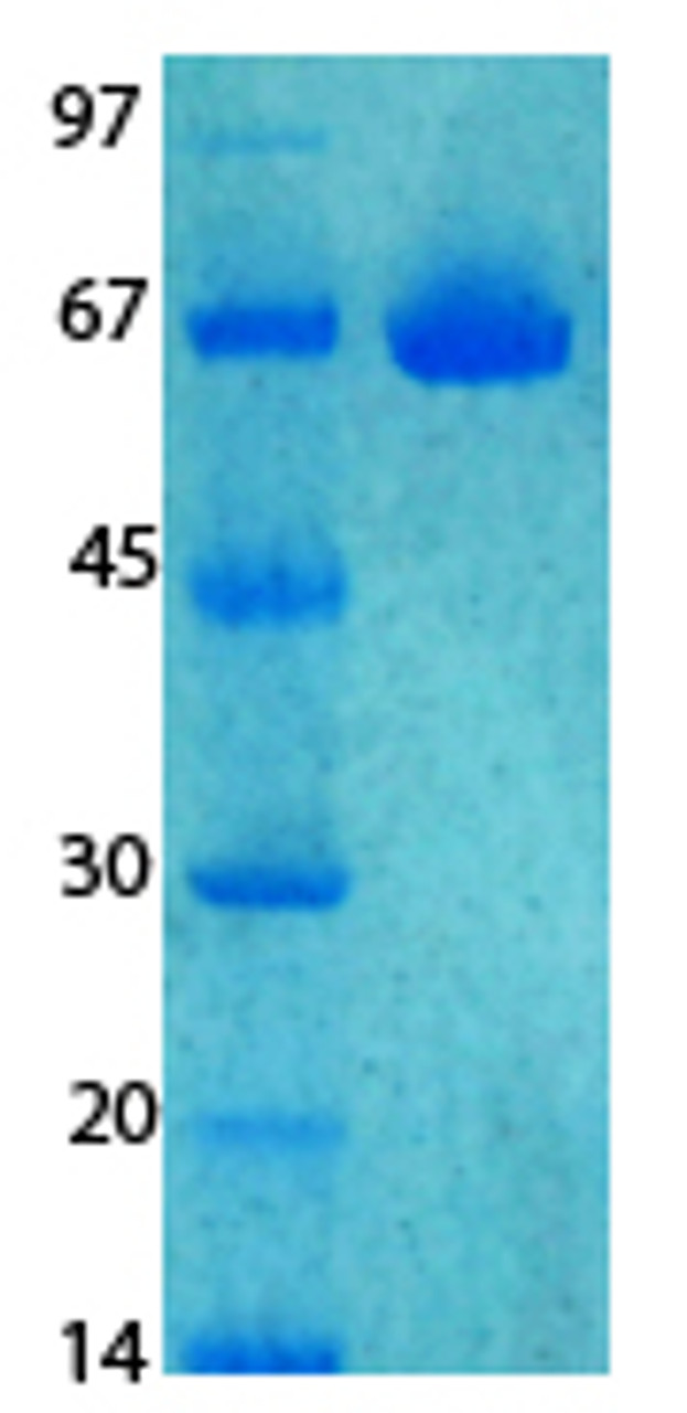 SARS-CoV-2 (COVID-19) NSP8 Recombinant Protein | 20-213