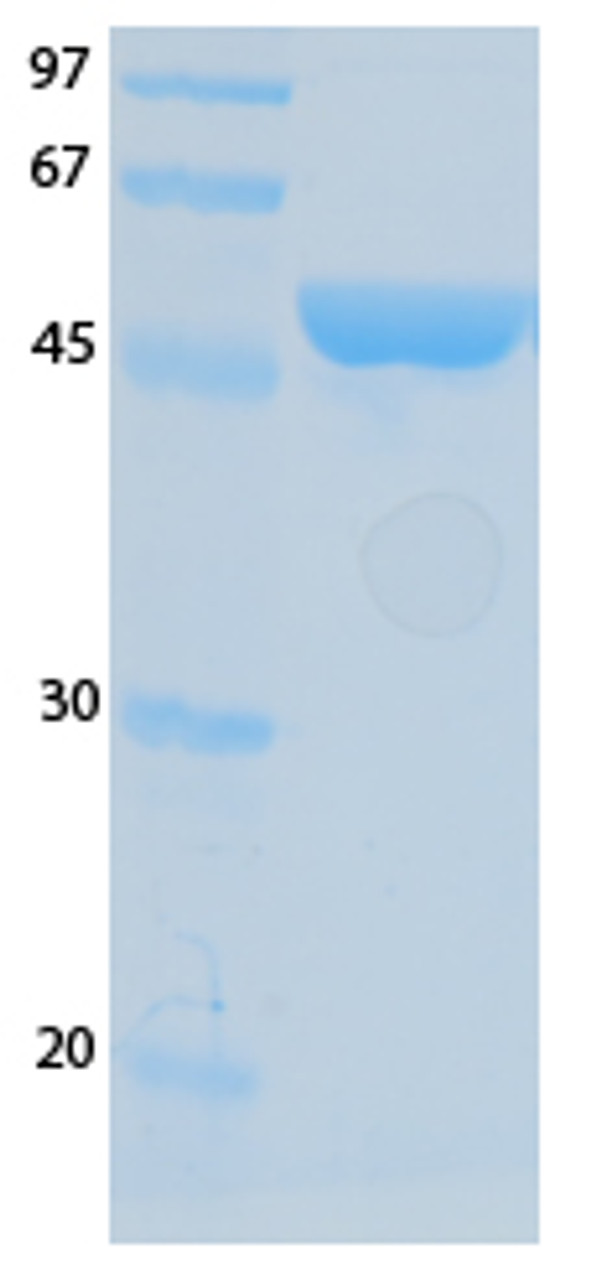 SARS-CoV-2 (COVID-19) NSP7 Recombinant Protein | 20-214