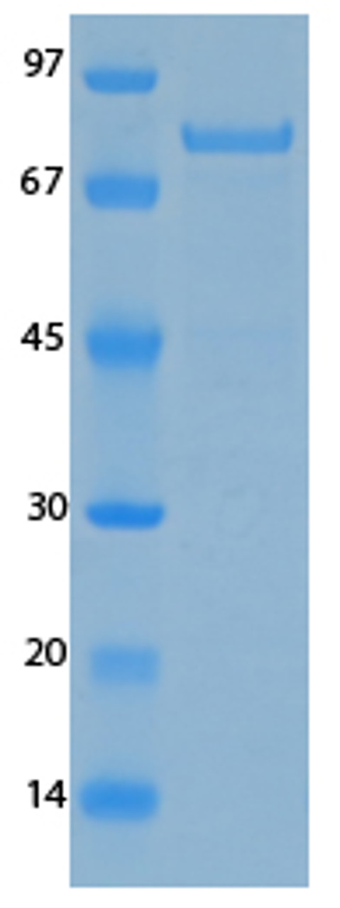 SARS-CoV-2 (COVID-19) NSP5 Recombinant Protein | 20-215