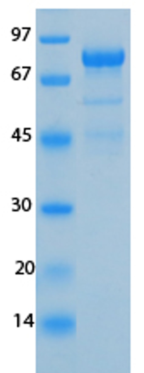 SARS-CoV-2 (COVID-19) NSP3 (743 - 1072) Recombinant Protein | 20-216