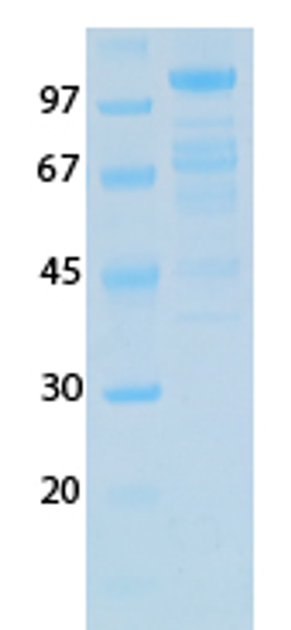SARS-CoV-2 (COVID-19) NSP2 Recombinant Protein | 20-217